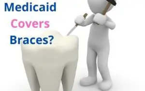 Does medicaid cover braces